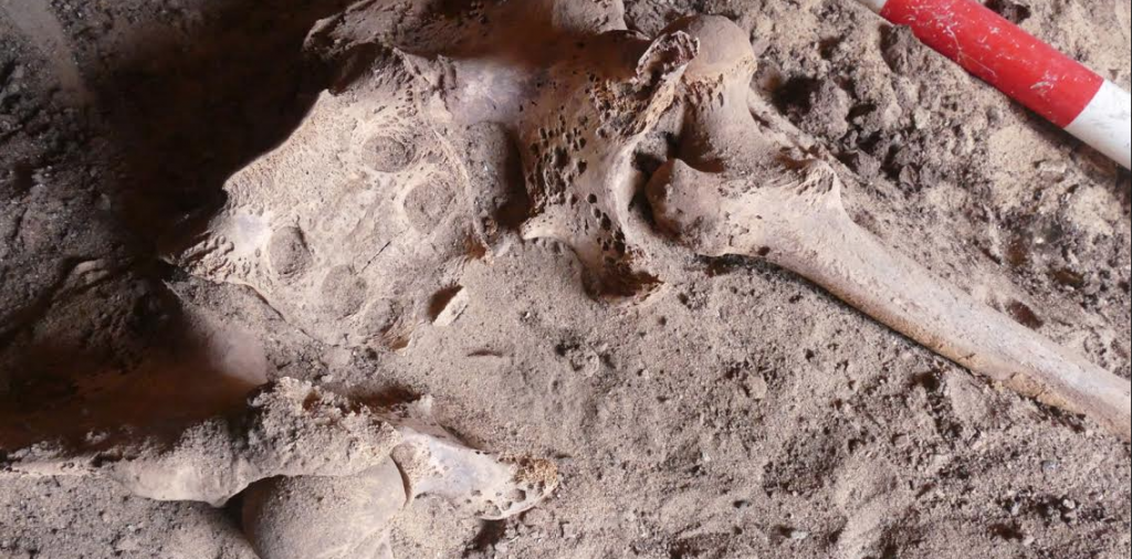 EL PRIMER CANCER DE MAMA. UJA